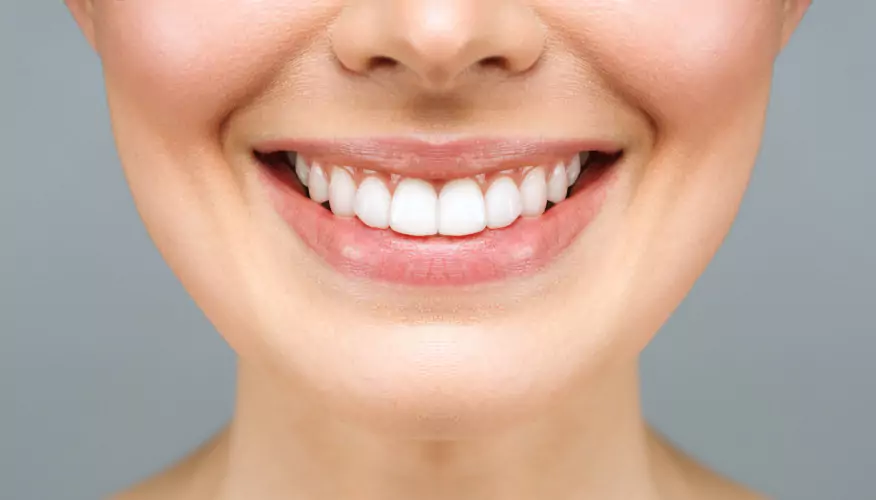 After teeth whitening treatment